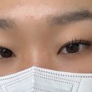 비니래쉬앤뷰티 이미지