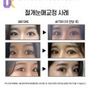 유케이성형외과 이미지