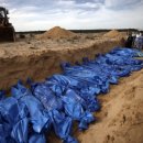 유니스메디칼 이미지