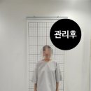 일산 주엽체형교정 바로체형 후기, 자세교정은 바로체형에서