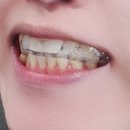 디메디코리아 이미지