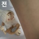 바디픽스 | ﹀ 붓기 완화 | 쿨링 · 온열 홈케어 제품 [ 바디픽스 액티브 롤 ]