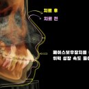 보우치과의원 이미지