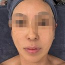 더블레스 | 위례에스테틱 더블레스 후기｜손끝으로 관리하는 테카테라피