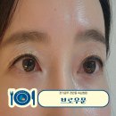 노대실로41번길L | 경기광주 경안동 브로우문뷰티에서 클리닉 속눈썹펌 받은 솔직후기