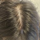 잇스토어영통점 | [영통두피] 수원두피 영통두피 영통동두피, 수원탈모관리 두피밥 수원점