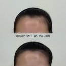 에이원헤어라인 이미지