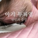 두피 염 원인과 증상, 대학병원 피부과 치료 후기, 두피 각질 치료 방법, 모유 수유 중 음식의 중요성
