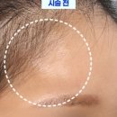 초이성형외과