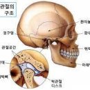 상악골 하악골 염증!!! 이미지