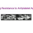 Drug Resistance to Antiplatelet Agent 이미지