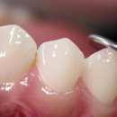 힐치과의원 이미지