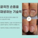 네일클리닉 - 평택시 고덕국제3길 136 | 네일클리닉