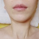 대박살롱 | 안산 고잔동피부관리 살롱드보떼 골드테라피 솔직 후기