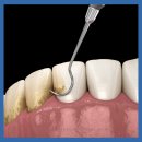 365서울차오름치과의원 이미지