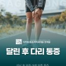 맑은하늘마취통증의학과의원 | 달린 후 무릎 바깥쪽 뻐근함, 초보 러너들이 가장 많이 놓치는 원인