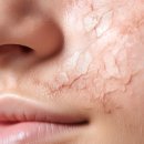 피부숨쉬다 이미지