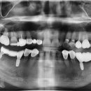 의정부본플란트치과의원 이미지