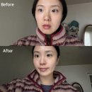이마트24 양산동원3차점 | 양산 에스테틱 뷰티센트리 피지관리 각질관리 솔직후기