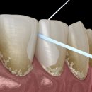 더플러스치과의원 이미지