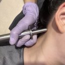 케어메디칼 | 대전 월평동 두피관리 닥터메디언스 대전두피에서 탈모 메디컬케어 후기