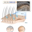 상봉 가발, 맞춤으로 해결한 후기! 멋진 남자 연출법