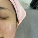 서산피부관리 잘하는곳 피부아지트뉴페이스 카복시추가 후기