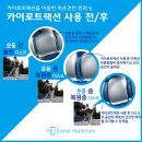 척추운동공간 이미지