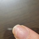 죽곡제일정형외과의원 네이버블로그