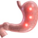 닥터코르셋 이미지