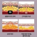 문샵 이미지