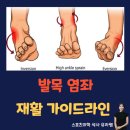 언더복싱박스 | [발과 발목 손상] 발목염좌 재활 가이드라인 A-Z