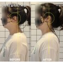 창원 상남동필라테스는 유핏_잦은 어깨와 목 통증? 거북목, 일자목 교정 스트레칭&amp;비포애프터