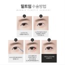 시원성형외과의원 이미지