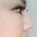 가장예쁜eye 이미지