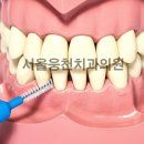 서울웅천치과의원 이미지