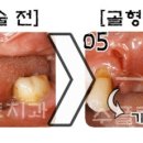 수플란트치과병원 이미지