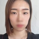 (주)아쿠아알앤디 | 김포경락 얼굴관리 3년 차 후기