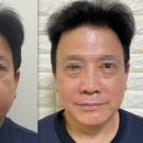 압구정튠의원 이미지