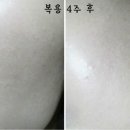 뷰티플러스(피부)