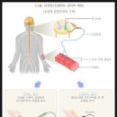 도수 근력 평가 (MMT : Manual Muscle Test) 이미지