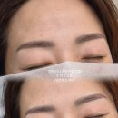 6495 | 대전연예인내츄럴 눈썹문신탈각후기, 대전여자눈썹문신 (대전캐츠아이)