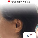 시그니아독일보청기 네이버블로그