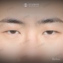 케이스성형외과