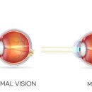 LS안경원 이미지