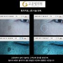 연향의원 티스토리