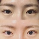 누니아 | [금천구청 속눈썹] 10년 경력 원장님이 1:1로 시술하는 속눈썹펌 후기 : 누니아