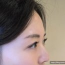 유니컬속눈썹 이미지