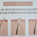 봄날홈케어 이미지