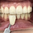 해맑은치과의원 이미지